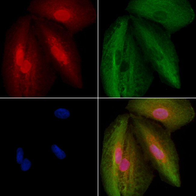 WDR83 Antibody in Immunocytochemistry (ICC/IF)