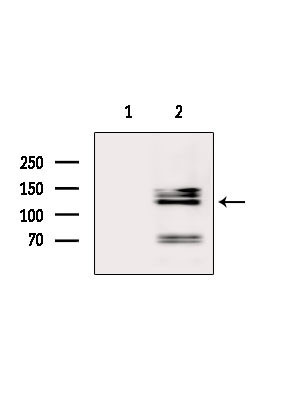 MSH3 Antibody in Western Blot (WB)