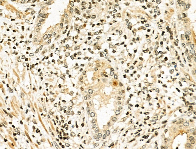 NFE2L1 Antibody in Immunohistochemistry (Paraffin) (IHC (P))