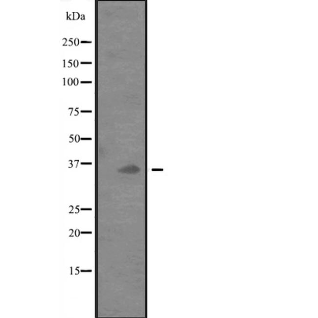 CD273 (B7-DC) Antibody in Western Blot (WB)