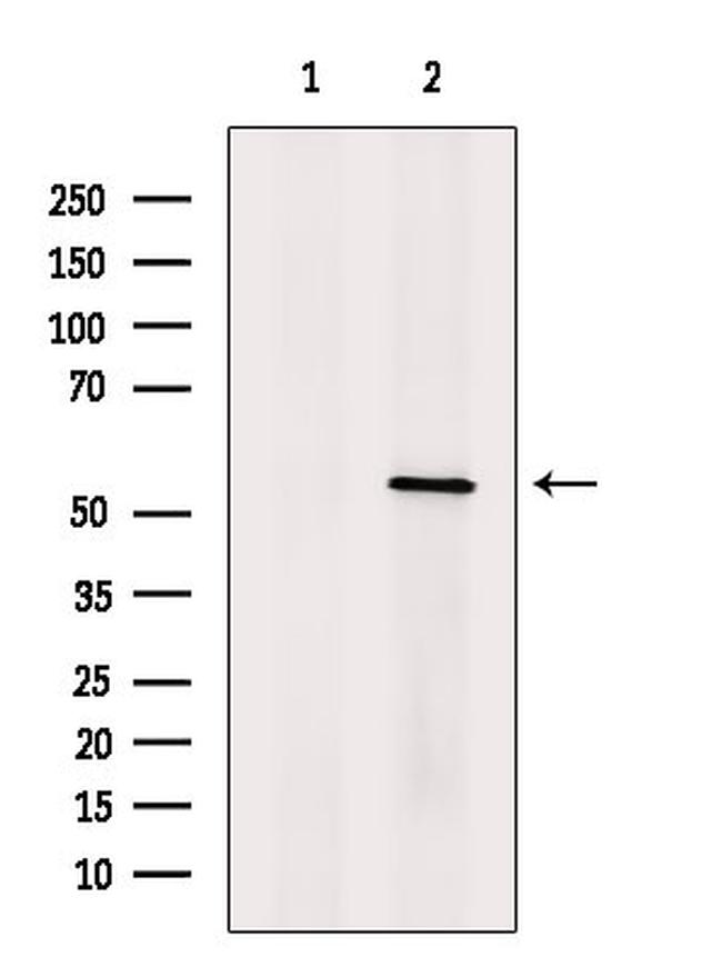Septin-10 Antibody in Western Blot (WB)