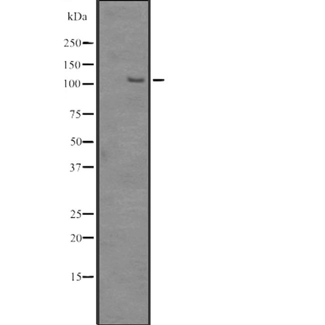 SRRM1 Antibody in Western Blot (WB)