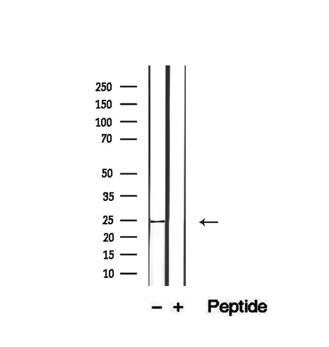 CD28 Antibody in Western Blot (WB)