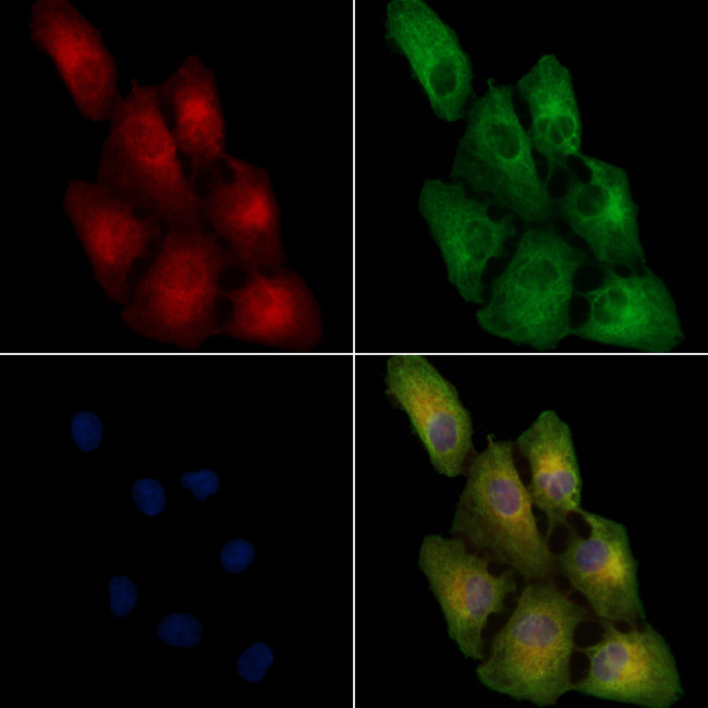 AASS Antibody in Immunocytochemistry (ICC/IF)