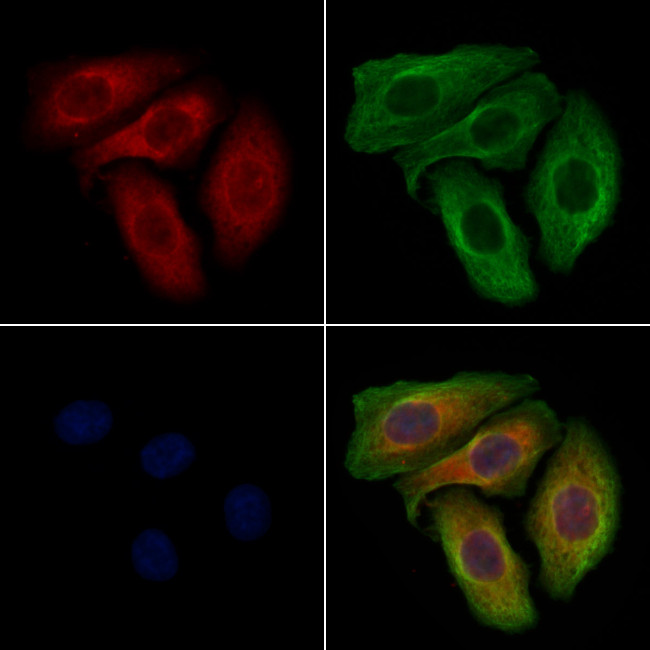 ABCB11 Antibody in Immunocytochemistry (ICC/IF)