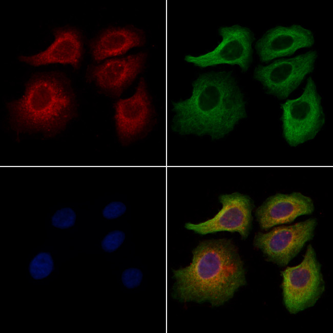 ACTR1A Antibody in Immunocytochemistry (ICC/IF)