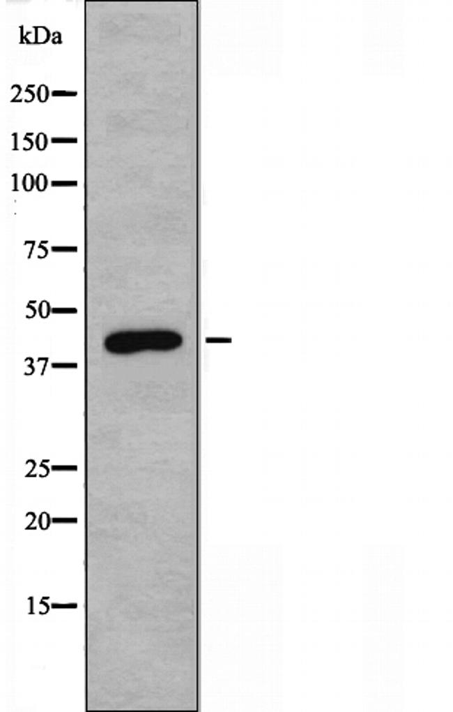ADPGK Antibody in Western Blot (WB)