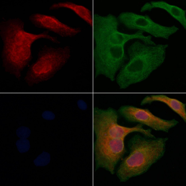 Apelin receptor Antibody in Immunocytochemistry (ICC/IF)