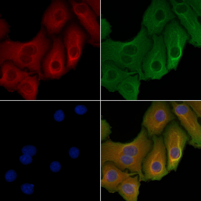 AHA1 Antibody in Immunocytochemistry (ICC/IF)