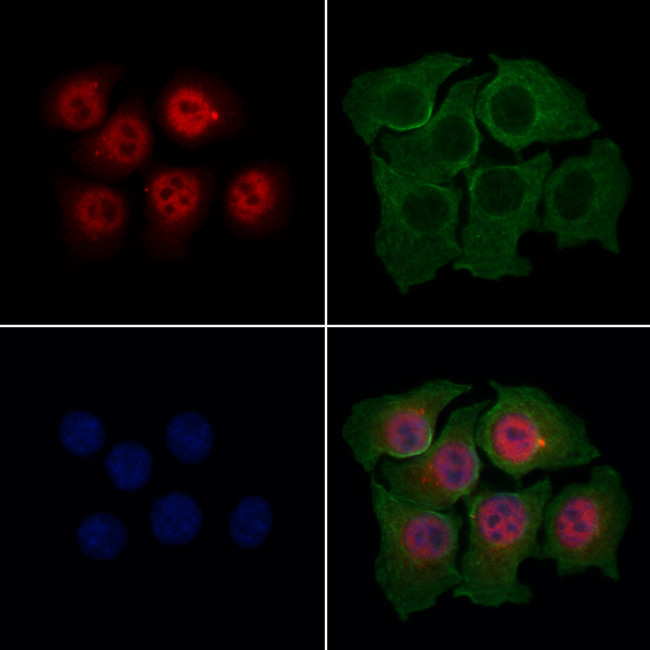 Aes Antibody in Immunocytochemistry (ICC/IF)
