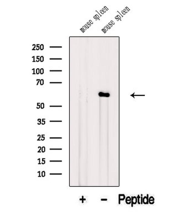 ANGPTL2 Antibody in Western Blot (WB)