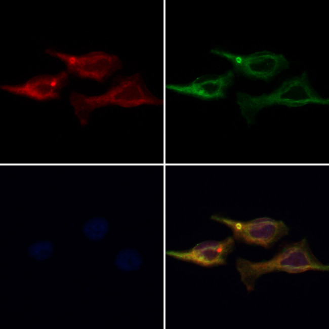 AP3M1 Antibody in Immunocytochemistry (ICC/IF)