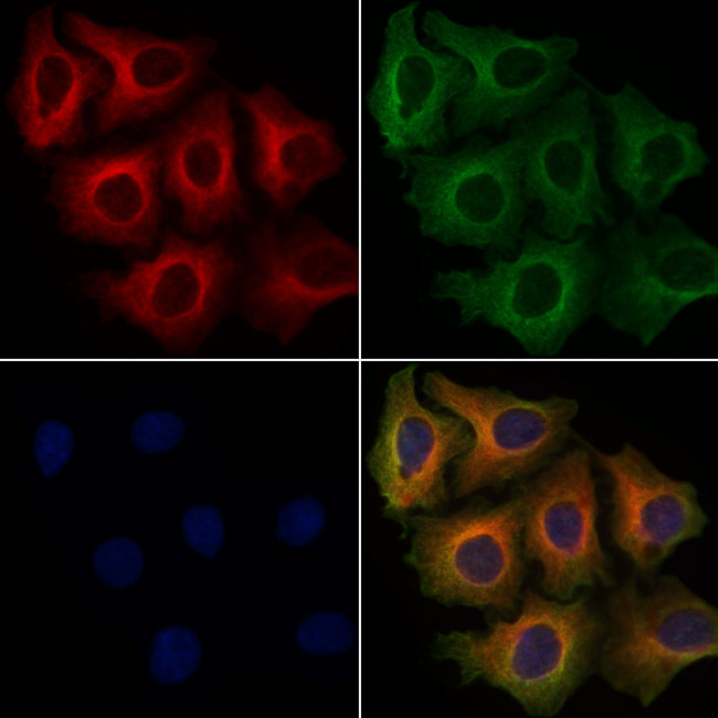 RIAM Antibody in Immunocytochemistry (ICC/IF)