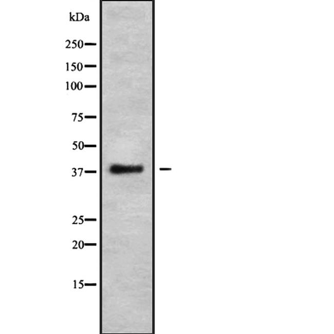 Apolipoprotein L6 Antibody in Western Blot (WB)