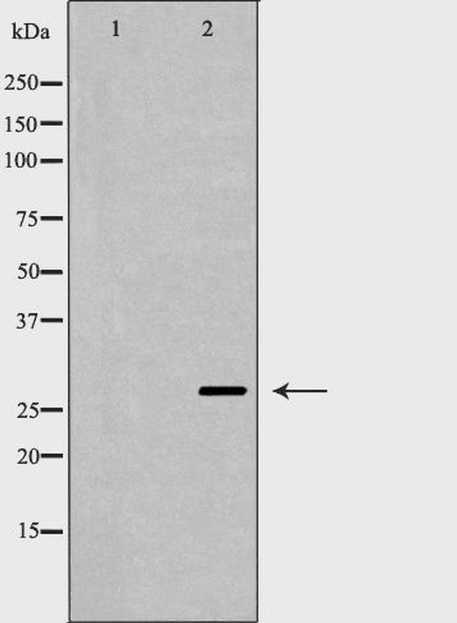Aquaporin 0 Antibody in Western Blot (WB)