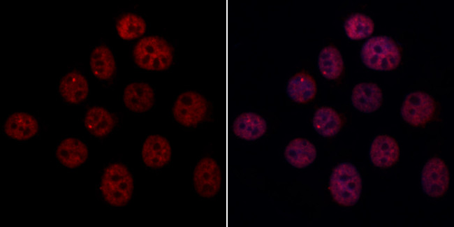 ARIH2 Antibody in Immunocytochemistry (ICC/IF)