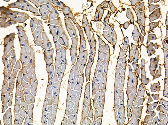 V-ATPase E1 Antibody in Immunohistochemistry (Paraffin) (IHC (P))