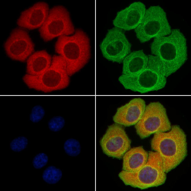 BAFF (BLyS) Antibody in Immunocytochemistry (ICC/IF)