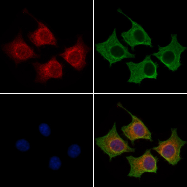 BAGE2 Antibody in Immunocytochemistry (ICC/IF)