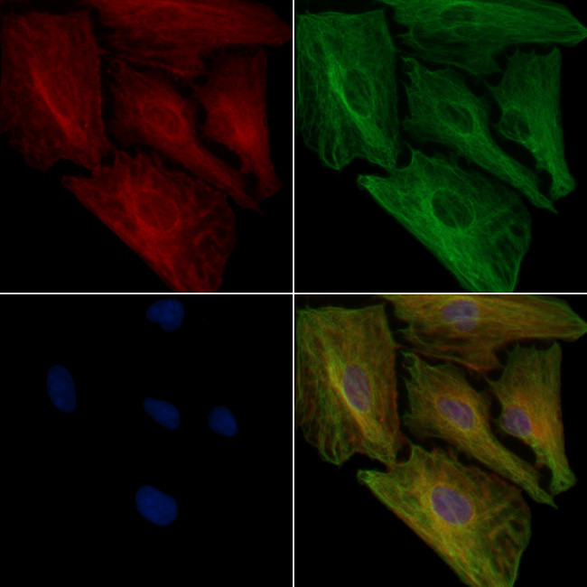 BAIAP2L1 Antibody in Immunocytochemistry (ICC/IF)
