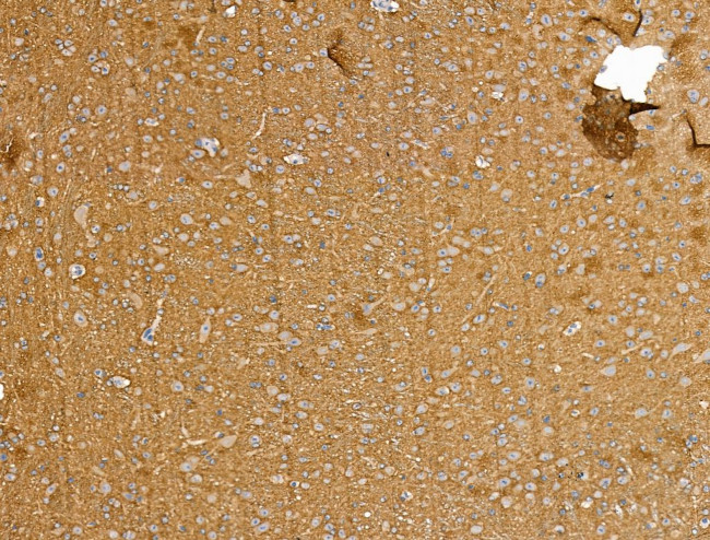 Bassoon Antibody in Immunohistochemistry (Paraffin) (IHC (P))