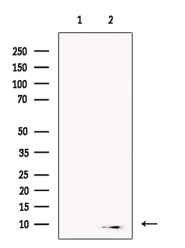 beta-3 Defensin Antibody in Western Blot (WB)