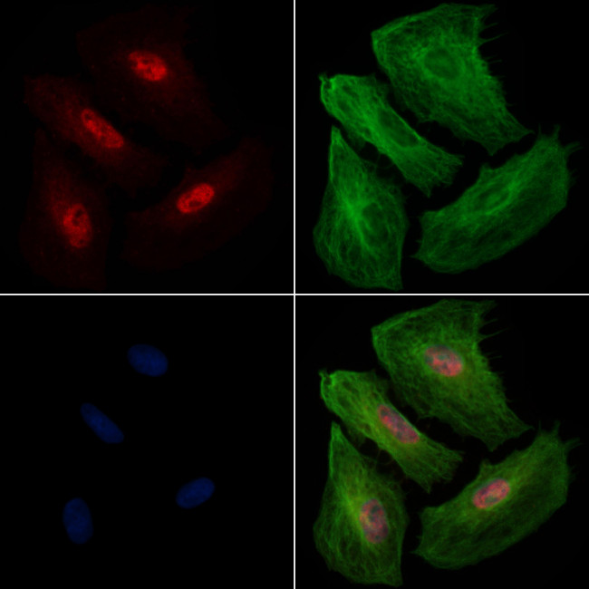 BIRC3 Antibody in Immunocytochemistry (ICC/IF)