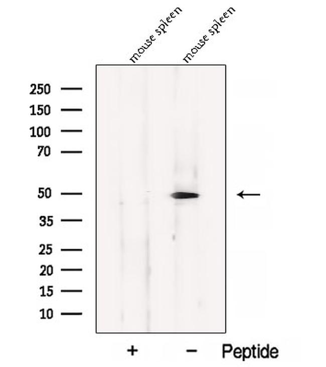 BLMH Antibody in Western Blot (WB)