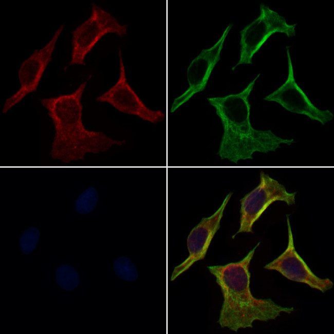 GDF10 Antibody in Immunocytochemistry (ICC/IF)