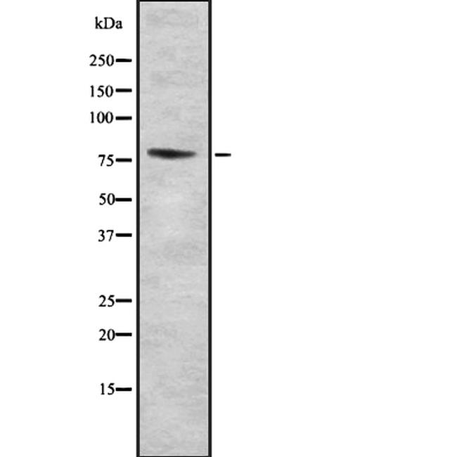 B Myb Polyclonal Antibody PA5 114913 b-myb-polyclonal-antibody-pa5-114913