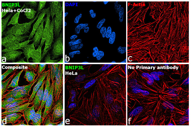 BNIP3L Antibody in Immunocytochemistry (ICC/IF)