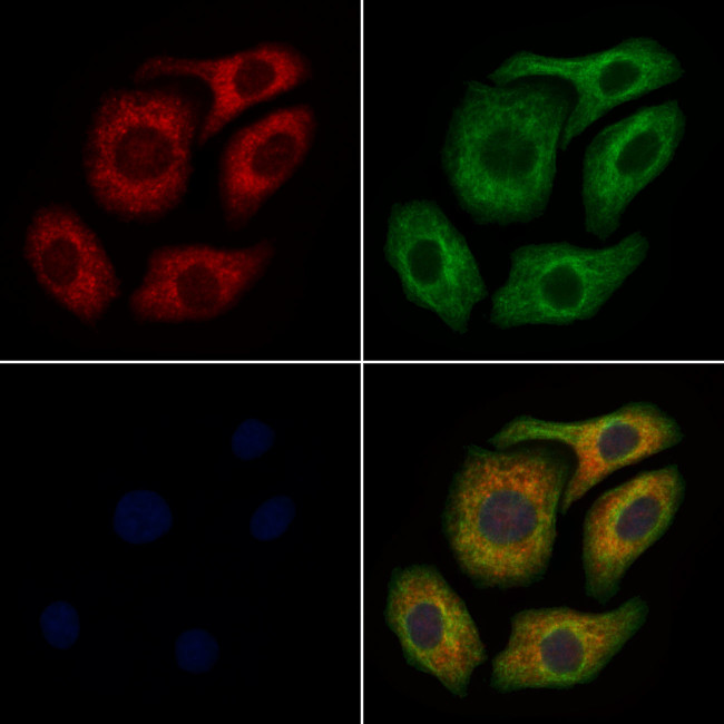 IBSP Antibody in Immunocytochemistry (ICC/IF)