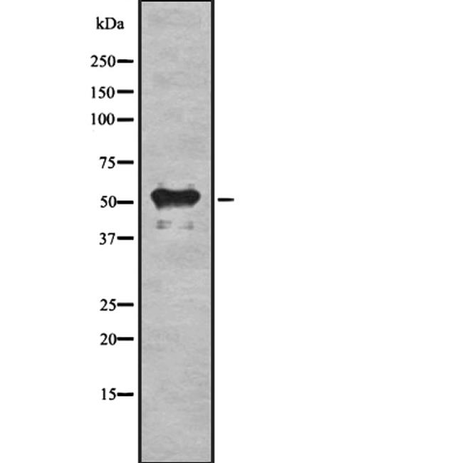 Bora Antibody in Western Blot (WB)