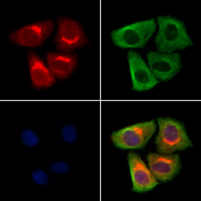 Seipin Antibody in Immunocytochemistry (ICC/IF)