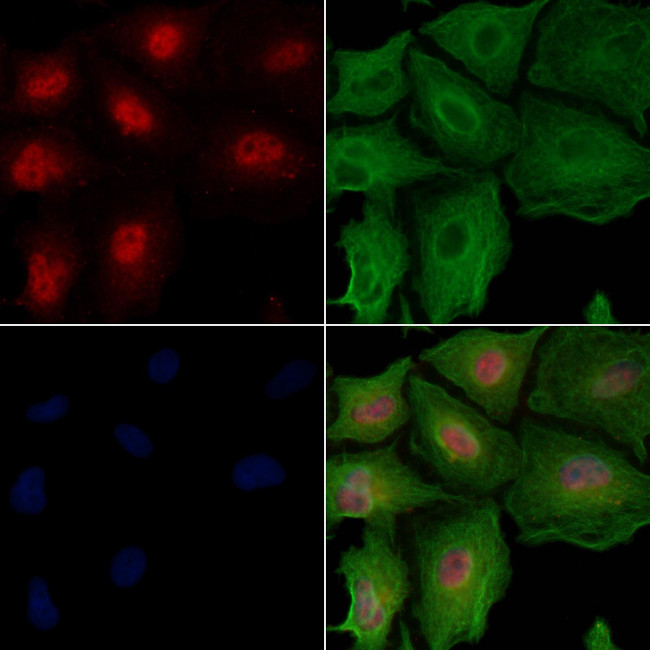 BUB1 Antibody in Immunocytochemistry (ICC/IF)