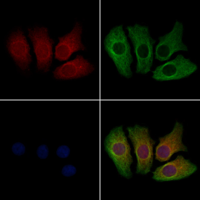 ATAT1 Antibody in Immunocytochemistry (ICC/IF)