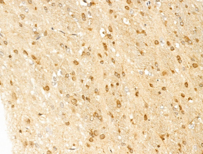 LAMTOR4 Antibody in Immunohistochemistry (Paraffin) (IHC (P))