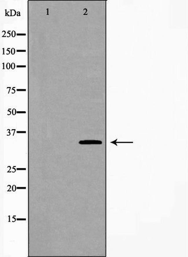 Carbonic Anhydrase IV Antibody in Western Blot (WB)