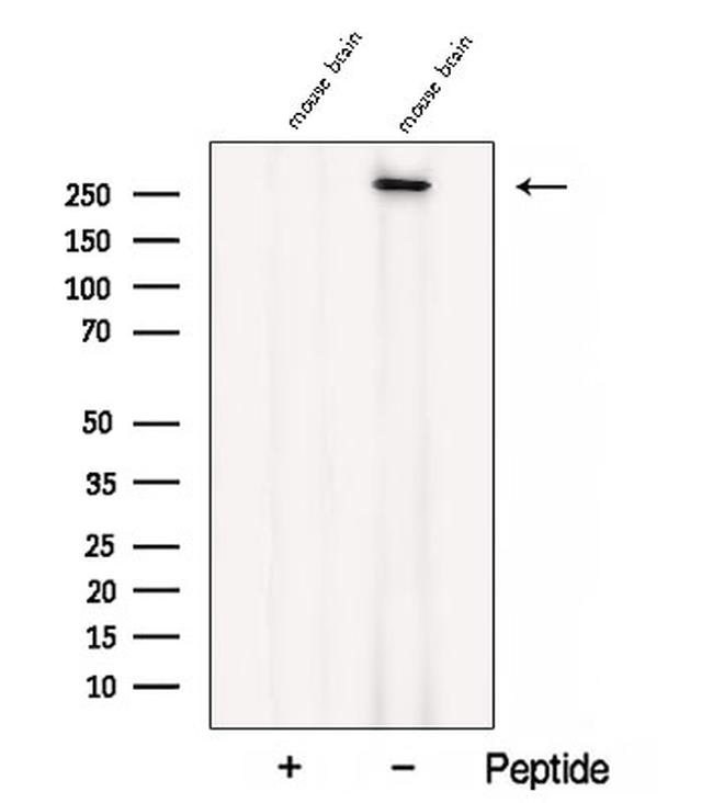 CACNA1B Antibody in Western Blot (WB)