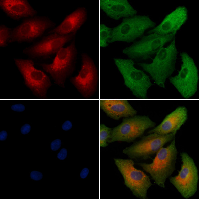 Calreticulin 3 Antibody in Immunocytochemistry (ICC/IF)