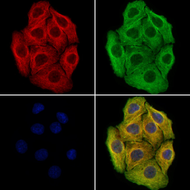 CAP1 Antibody in Immunocytochemistry (ICC/IF)