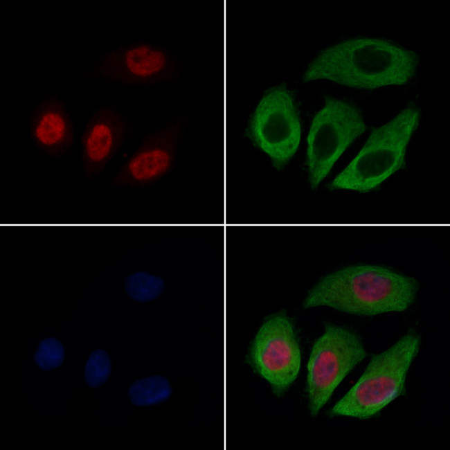 CASC5 Antibody in Immunocytochemistry (ICC/IF)