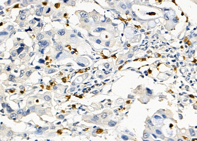 CSN1S1 Antibody in Immunohistochemistry (Paraffin) (IHC (P))