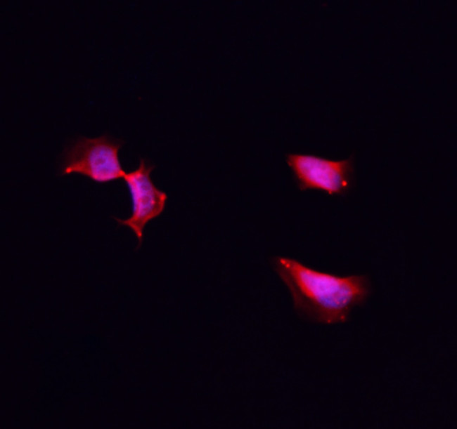 CK1 alpha Antibody in Immunocytochemistry (ICC/IF)