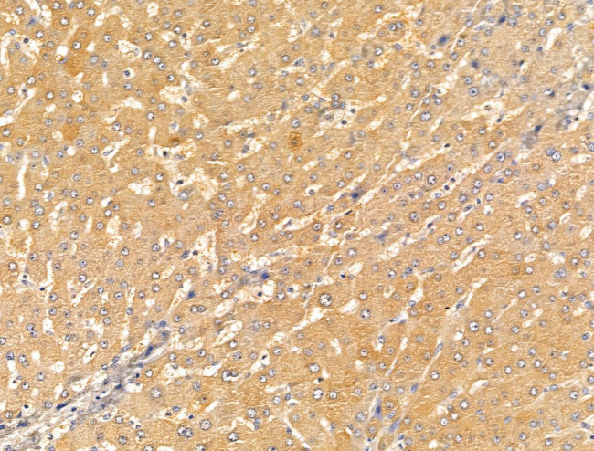 SLC7A1 Antibody in Immunohistochemistry (Paraffin) (IHC (P))