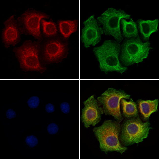 CCDC28A Antibody in Immunocytochemistry (ICC/IF)