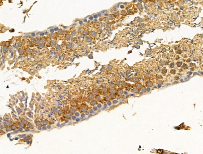 CCDC34 Antibody in Immunohistochemistry (Paraffin) (IHC (P))