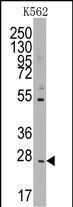 CD8 beta Antibody in Western Blot (WB)