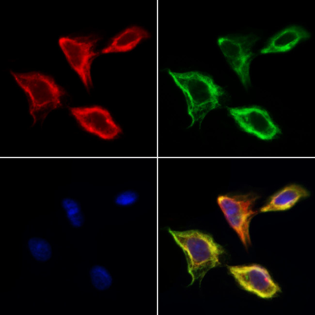 CD166 Antibody in Immunocytochemistry (ICC/IF)