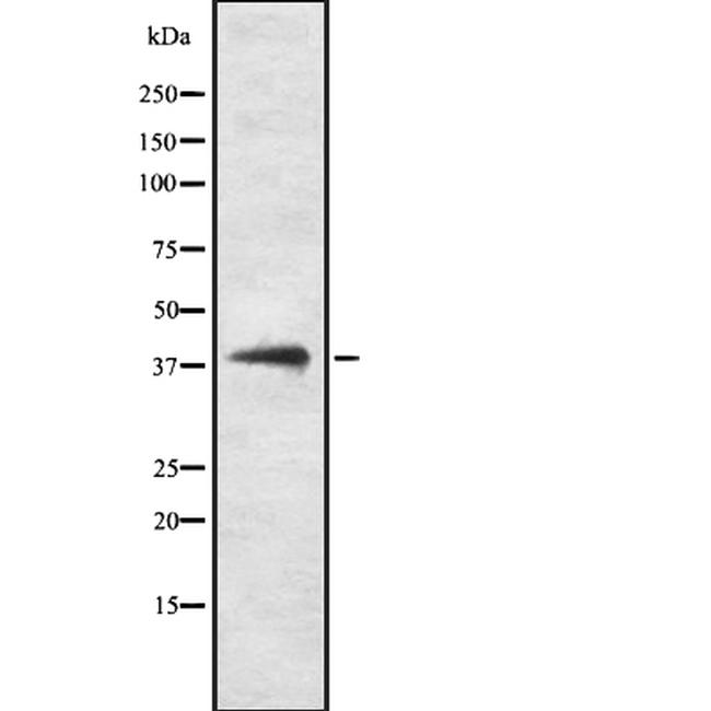 CD2 Antibody in Western Blot (WB)